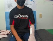 Honduran Patient Regains Use of Finger Following Successful Operation by Navy Medicine Surgeons