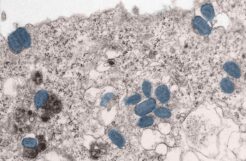 Mpox Vaccine Available on Demand for Troops as Infections Trigger Travel Warning
