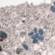 Mpox Vaccine Available on Demand for Troops as Infections Trigger Travel Warning